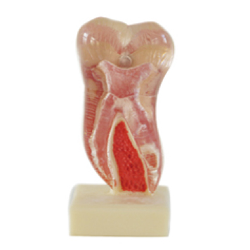 Jingle JG-YS5 — Модель моляра нижней челюсти, увеличенный в 6 раз