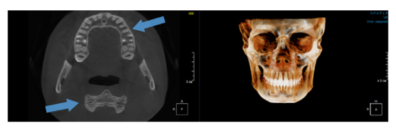 Критерии выбора конусно-лучевого компьютерного томографа.-05 (1).jpg