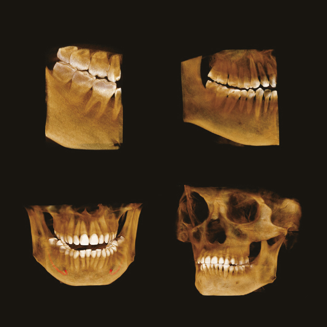 4e9a90f255921de125017baadbc3c243.jpg 4e9a90f255921de125017baadbc3c243.jpg