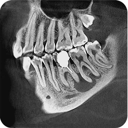 756273e2623420e0e796d77f551404ab.png 756273e2623420e0e796d77f551404ab.png