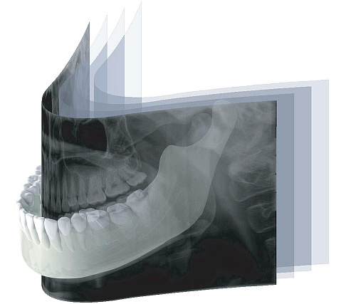 GENORAY Papaya - ортопантомограф