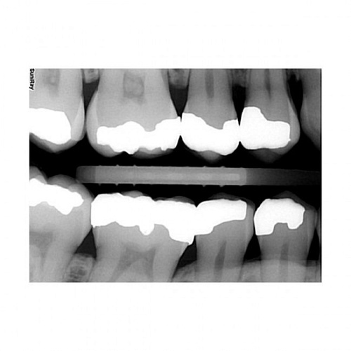 Suni SuniRay2 - система компьютерной радиовизиографии