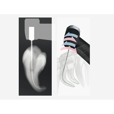 J.Morita Tri Auto ZX2 - беспроводной эндодонтический микромотор со встроенным апекслокатором