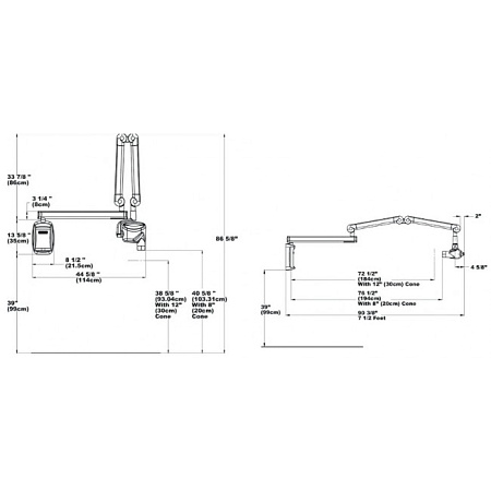 Progeny Preva DC - интраоральный рентген (настенная версия)