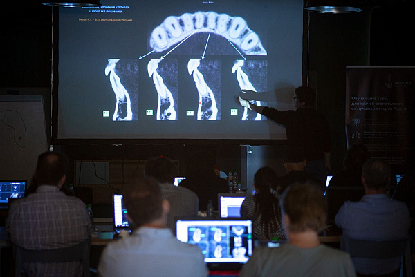 Юрия Седова- «Конусно-лучевая компьютерная томография в практике врача-стоматолога»_10.jpg