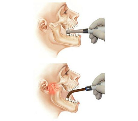 Geosoft ESTUS-LED-ALLADIN Multicolor - фотополимеризатор