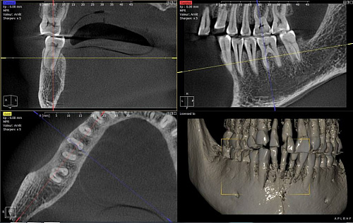 Owandy I-Max Touch 3D – Конусно-лучевой томограф 9х8