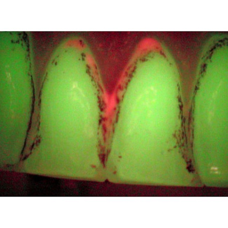 Durr Dental VistaCam IX – интраоральная видеокамера с системой сменых насадок CAM, Proof