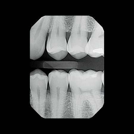 KaVo Gendex GXS-700 - система компьютерной радиовизиографии (сенсор №1)