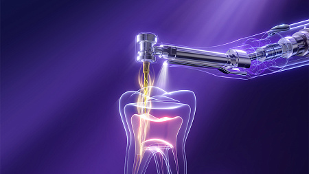 Woodpecker Endo GR Pro — Эндомотор с автоматическим определением крутящего момента и встроенным апекслокатором