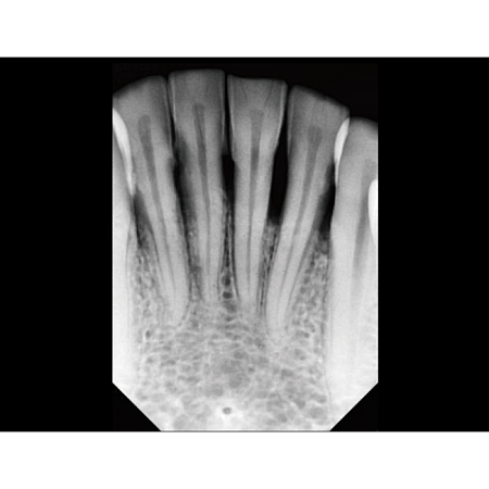 Vatech EzRay Air Wall - высокочастотный настенный дентальный рентген