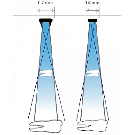 Progeny Preva DC - интраоральный рентген (настенная версия)
