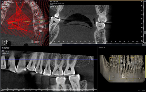 Owandy I-Max Touch 3D – Конусно-лучевой томограф 9х8