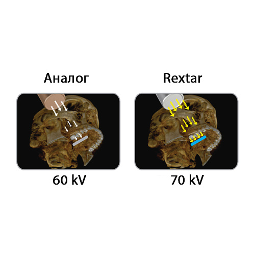 POSDION Rextar - портативный рентген